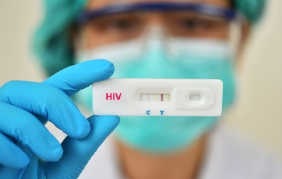 Ministério da Saúde orienta farmácias a realizar testes rápidos de HIV